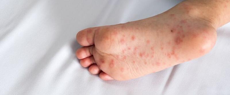 Zagrożenia zdrowotne