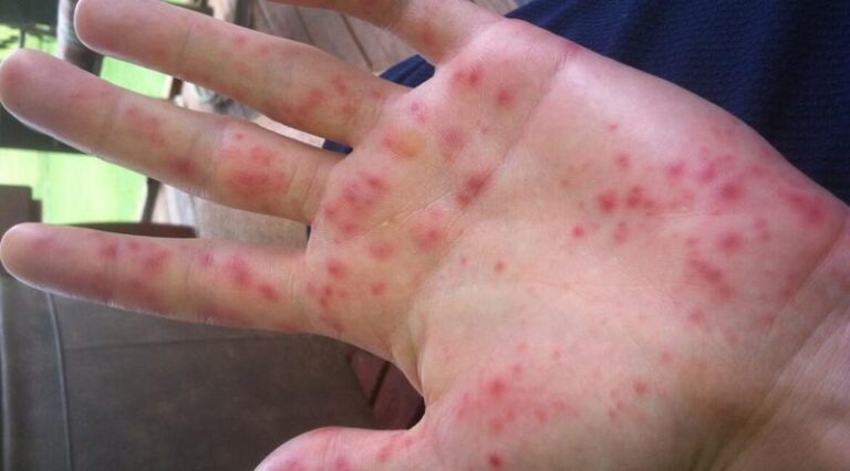 Czy wirus bostoński wymusza zostanie w domu? Co warto wiedzieć przed wyjściem na zewnątrz